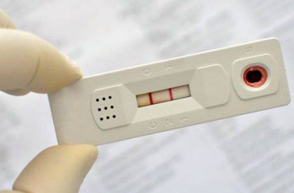 Curso de Enfermagem e Programa Municipal de IST’s realizam testes rápidos para comunidade acadêmica